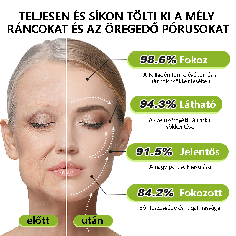 💫🪄🌟Magyarországon készült, közvetlenül Magyarországról szállítjuk 💫Rolimey® Botox és Retinol Szérum – Emeli és feszesíti a bőrt, csökkenti a ráncokat – Az akció utolsó napja, 70% KEDVEZMÉNY az egész üzletben
