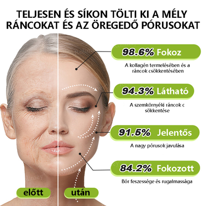 💫🪄🌟Magyarországon készült, közvetlenül Magyarországról szállítjuk 💫Rolimey® Botox és Retinol Szérum – Emeli és feszesíti a bőrt, csökkenti a ráncokat – Az akció utolsó napja, 70% KEDVEZMÉNY az egész üzletben