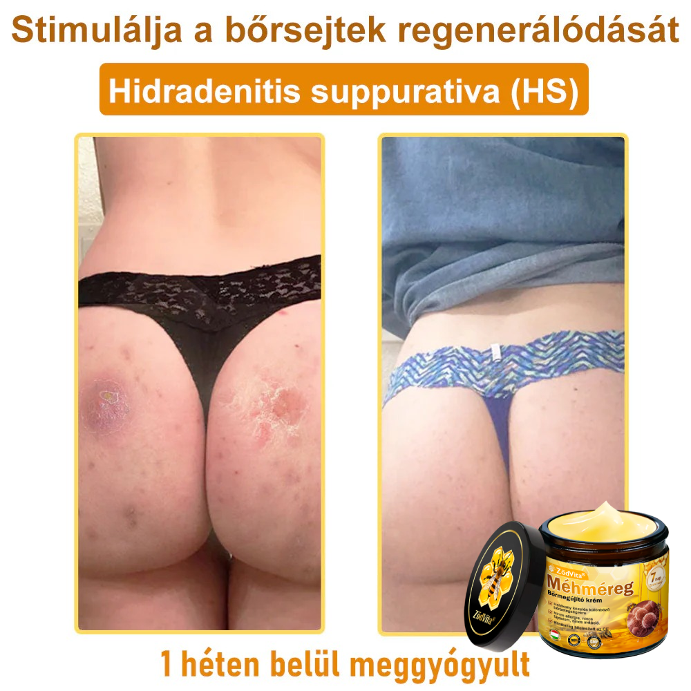 🐝🌿 ZödVita® Méhméreg Bőr Helyreállító Krém 🔥 Magyar fejlesztés, magyarországi gyártás és szállítás