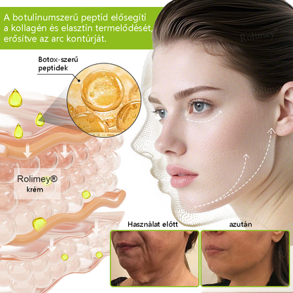 💫🪄🌟Magyarországon készült, közvetlenül Magyarországról szállítjuk 💫Rolimey® Botox és Retinol Szérum – Emeli és feszesíti a bőrt, csökkenti a ráncokat – Az akció utolsó napja, 70% KEDVEZMÉNY az egész üzletben