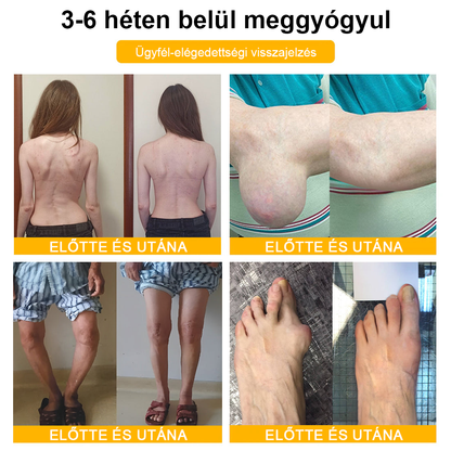 💎TLOPA® Botulinum Toxin és Méhméreg Fájdalomcsillapító Csontgyógyító Krém🐝 🔥(Kifejezetten időseknek & ortopéd szakorvosok ajánlásával)🦴
