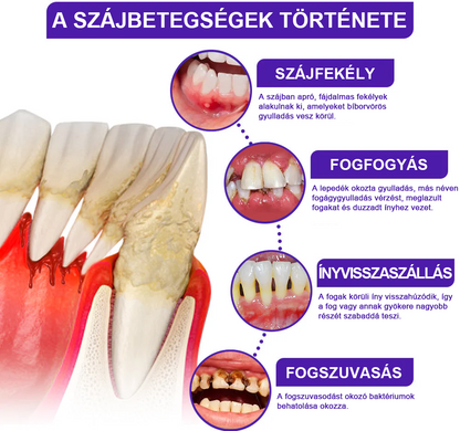 🌟Rolimey® VioCore Méhméreg Fogkezelő Fogkrém