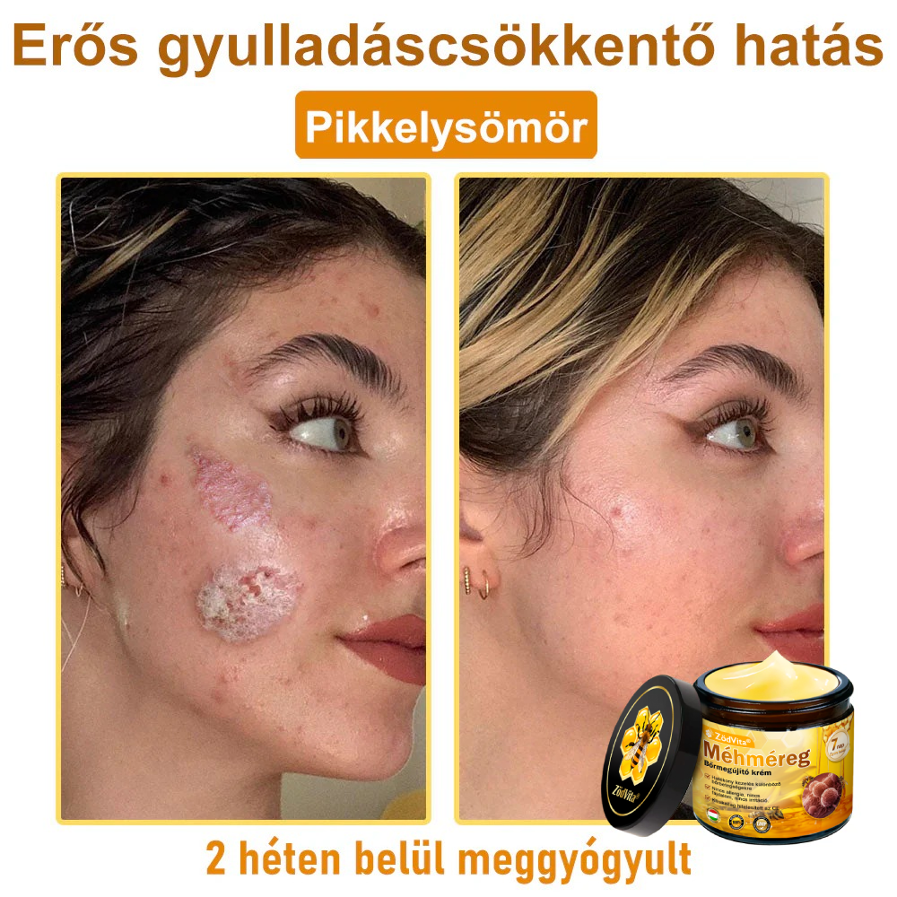 🐝🌿 ZödVita® Méhméreg Bőr Helyreállító Krém 🔥 Magyar fejlesztés, magyarországi gyártás és szállítás