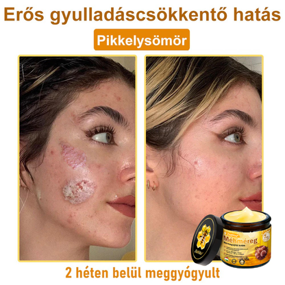 🐝🌿 ZödVita® Méhméreg Bőr Helyreállító Krém 🔥 Magyar fejlesztés, magyarországi gyártás és szállítás