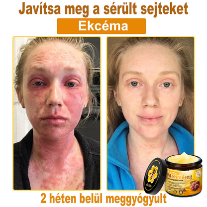 🐝🌿 ZödVita® Méhméreg Bőr Helyreállító Krém 🔥 Magyar fejlesztés, magyarországi gyártás és szállítás