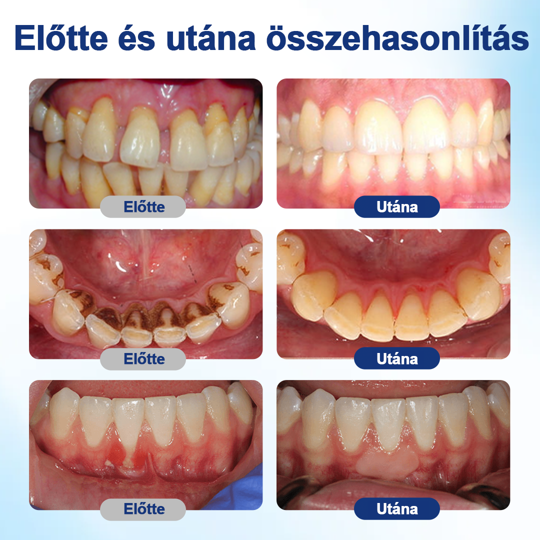 🎁🎁HEATWOLF® BeeTakt Szájápoló Regeneráló Oldat 🦷Fejlett bioaktív formula a szájüreg átfogó regeneráló támogatására