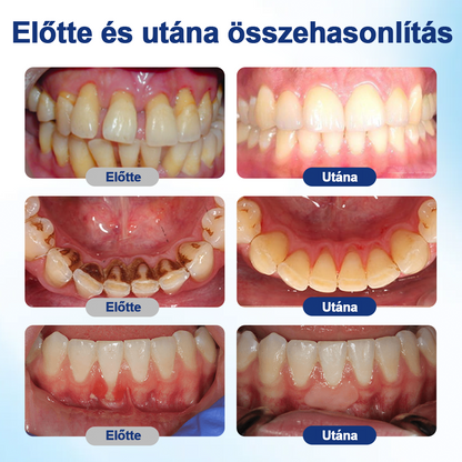 🎁🎁HEATWOLF® BeeTakt Szájápoló Regeneráló Oldat 🦷Fejlett bioaktív formula a szájüreg átfogó regeneráló támogatására
