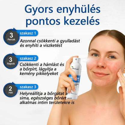 CleraNature® Magnéziumos Spray – Gyors Enyhülés Viszkető, Vörös és Érzékeny Bőrre (Még Intim Területeken is)