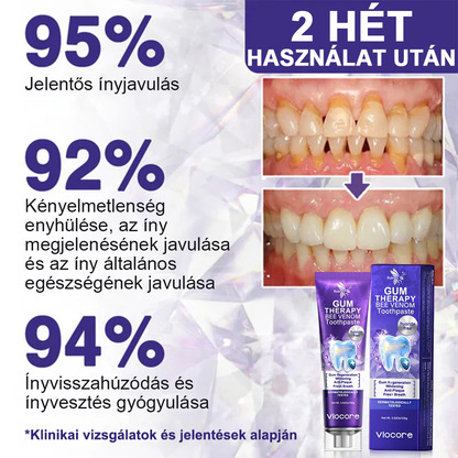 🌟Rolimey® VioCore Méhméreg Fogkezelő Fogkrém