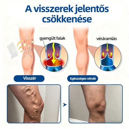 🌲Healrize® Vénacélpont mikrotűs tapasz⚡Azonnali enyhülés hosszú távú eredmények🇭🇺