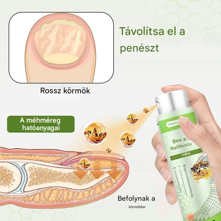 Korlátozott ideig 50%-os kedvezmény | Foulme® NailRescue Méhméreg Spray🐝