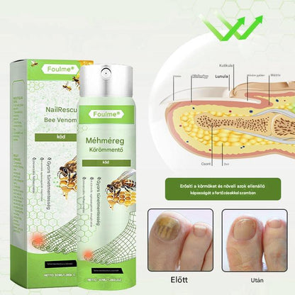 Korlátozott ideig 50%-os kedvezmény | Foulme® NailRescue Méhméreg Spray🐝