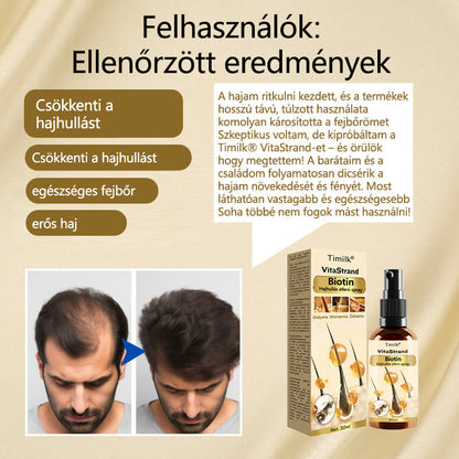 Timilk® VitaStrand Biotin hajnövekedést elősegítő spray✅ Sűrű, fényes haj néhány hét alatt🔥🔥🔥🔥