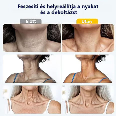 Rollerball masszázs nyakkrém 🧴 Kollagén és hialuronsav | Feszesíti a nyakat, csökkenti a nyaki ráncokat és a tokát