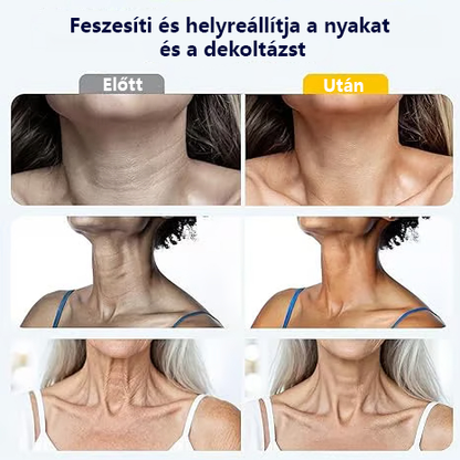 Rollerball masszázs nyakkrém 🧴 Kollagén és hialuronsav | Feszesíti a nyakat, csökkenti a nyaki ráncokat és a tokát