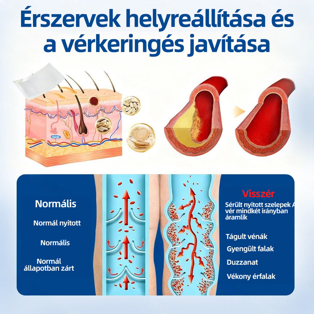 🌲Healrize® Vénacélpont mikrotűs tapasz⚡Azonnali enyhülés hosszú távú eredmények🇭🇺