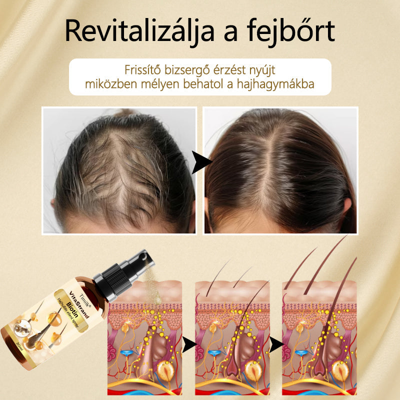 Timilk® VitaStrand Biotin hajnövekedést elősegítő spray✅ Sűrű, fényes haj néhány hét alatt🔥🔥🔥🔥