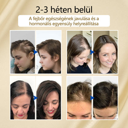 Timilk® VitaStrand Biotin hajnövekedést elősegítő spray✅ Sűrű, fényes haj néhány hét alatt🔥🔥🔥🔥