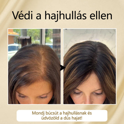 Timilk® VitaStrand Biotin hajnövekedést elősegítő spray✅ Sűrű, fényes haj néhány hét alatt🔥🔥🔥🔥
