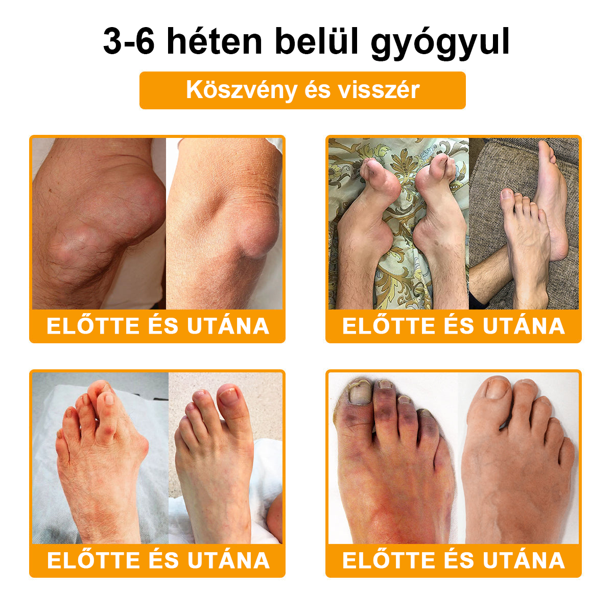 💎TLOPA® Botulinum Toxin és Méhméreg Fájdalomcsillapító Csontgyógyító Krém🐝 🔥(Kifejezetten időseknek & ortopéd szakorvosok ajánlásával)🦴