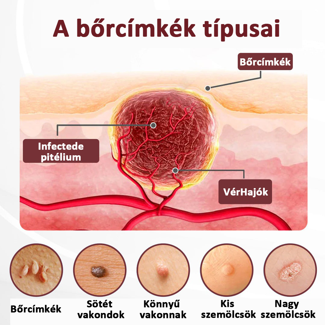 Biancat®KeraErase Dual-Action Renewal Cream