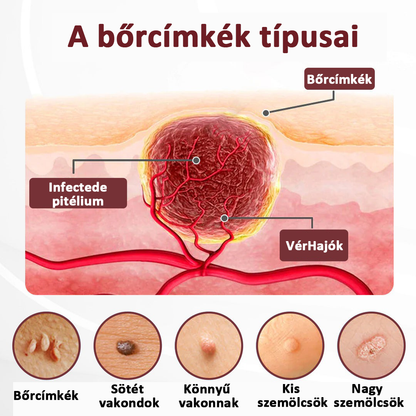 Biancat®KeraErase Dual-Action Renewal Cream