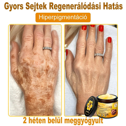 🐝🌿 ZödVita® Méhméreg Bőr Helyreállító Krém 🔥 Magyar fejlesztés, magyarországi gyártás és szállítás