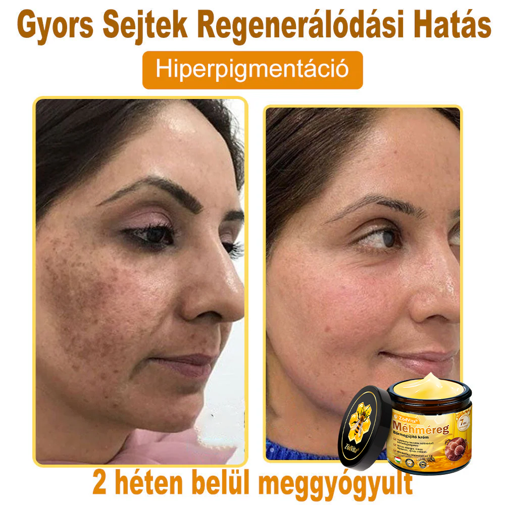 🐝🌿 ZödVita® Méhméreg Bőr Helyreállító Krém 🔥 Magyar fejlesztés, magyarországi gyártás és szállítás